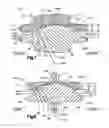 Fig. 06 - Articulating disc implant