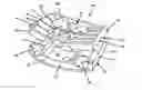 Fig. 01 - Intervertebral cage and method of treating vertebrae with an intervertebral cage