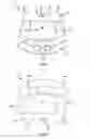 Fig. 05 - Intervertebral cage and method of treating vertebrae with an intervertebral cage