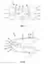 Fig. 06 - Intervertebral cage and method of treating vertebrae with an intervertebral cage