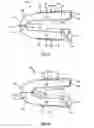 Fig. 09 - Intervertebral cage and method of treating vertebrae with an intervertebral cage
