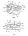 Fig. 13 - Intervertebral cage and method of treating vertebrae with an intervertebral cage