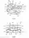 Fig. 15 - Intervertebral cage and method of treating vertebrae with an intervertebral cage