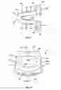 Fig. 19 - Intervertebral cage and method of treating vertebrae with an intervertebral cage