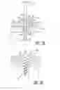 Fig. 06 - Customized surgical guide