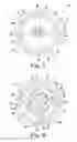 Fig. 03 - Surgical method for implanting a stemless humeral component to the humerus of a patient