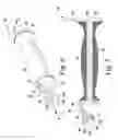 Fig. 05 - Surgical method for implanting a stemless humeral component to the humerus of a patient