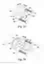 Fig. 12 - Surgical method for implanting a stemless humeral component to the humerus of a patient