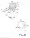 Fig. 13 - Surgical method for implanting a stemless humeral component to the humerus of a patient