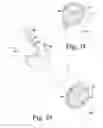 Fig. 17 - Surgical method for implanting a stemless humeral component to the humerus of a patient