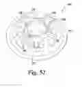 Fig. 28 - Surgical method for implanting a stemless humeral component to the humerus of a patient