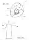 Fig. 16 - IMPLANT TRIALLING