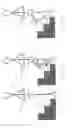 Fig. 02 - Control of a passive prosthetic knee joint with adjustable damping