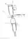 Fig. 01 - PROSTHETIC SUSPENSION MOUNTING ASSEMBLY