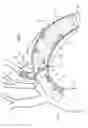 Fig. 02 - Multi-component stent-graft system for aortic dissections
