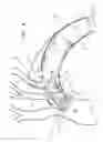 Fig. 07 - Multi-component stent-graft system for aortic dissections