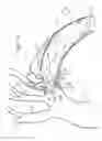 Fig. 09 - Multi-component stent-graft system for aortic dissections
