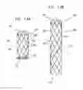 Fig. 12 - Multi-component stent-graft system for aortic dissections