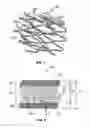 Fig. 02 - Implantable prosthesis with radiopaque particles and method of making same