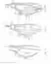 Fig. 07 - Stent-graft with positioning anchor
