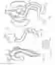 Fig. 10 - Stent-graft with positioning anchor