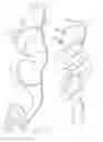 Fig. 13 - Stent-graft with positioning anchor