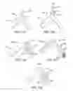 Fig. 16 - Method of making a stent