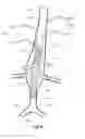Fig. 04 - Stent graft adaptor