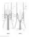 Fig. 06 - Stent graft adaptor