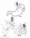 Fig. 03 - Upper stomach gastric implants