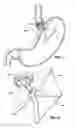 Fig. 07 - Upper stomach gastric implants