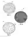 Fig. 10 - Upper stomach gastric implants