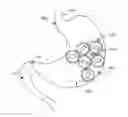 Fig. 01 - Magnetic device to control obesity and related method of use