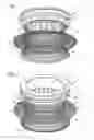 Fig. 02 - Implant