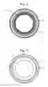 Fig. 03 - Implant