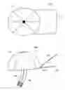 Fig. 01 - DEVICE FOR THE HINDRANCE OF SNORING AND OBSTRUCTIVE SLEEP APNEA