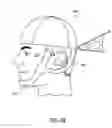 Fig. 08 - DEVICE FOR THE HINDRANCE OF SNORING AND OBSTRUCTIVE SLEEP APNEA