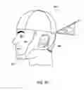 Fig. 09 - DEVICE FOR THE HINDRANCE OF SNORING AND OBSTRUCTIVE SLEEP APNEA