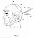 Fig. 10 - DEVICE FOR THE HINDRANCE OF SNORING AND OBSTRUCTIVE SLEEP APNEA