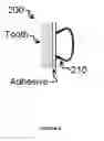 Fig. 03 - DENTAL RETAINER SYSTEM