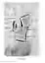 Fig. 06 - Cerebral protection system