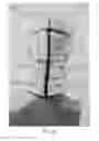 Fig. 07 - Cerebral protection system