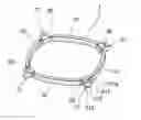 Fig. 01 - PUPIL EXPANDER