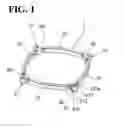Fig. 02 - PUPIL EXPANDER