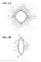 Fig. 03 - PUPIL EXPANDER