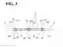 Fig. 04 - PUPIL EXPANDER