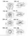 Fig. 05 - PUPIL EXPANDER