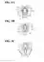 Fig. 06 - PUPIL EXPANDER
