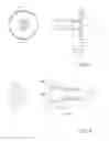 Fig. 03 - Opthalmic device for cell removal