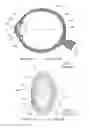 Fig. 02 - System and apparatus for treating the lens of an eye